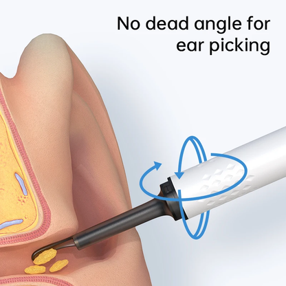 Smart Ear Cleaner with HD Camera – Safe Wireless Earwax Removal Tool for Adults & Kids