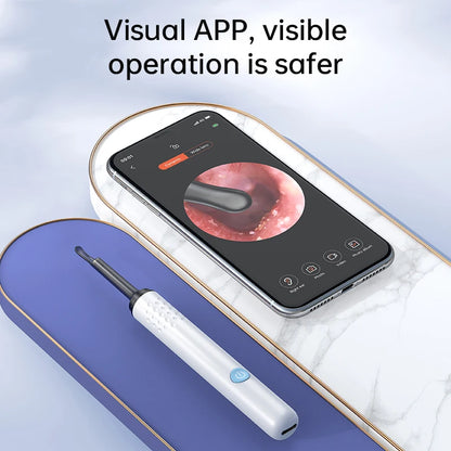 Smart Ear Cleaner with HD Camera – Safe Wireless Earwax Removal Tool for Adults & Kids